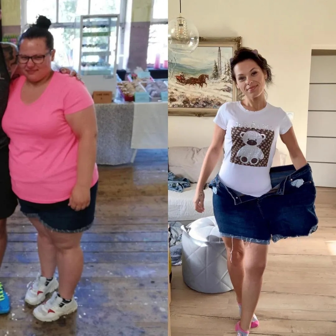 Czy skóra po odchudzaniu się wchłonie? Poznaj prawdę o elastyczności